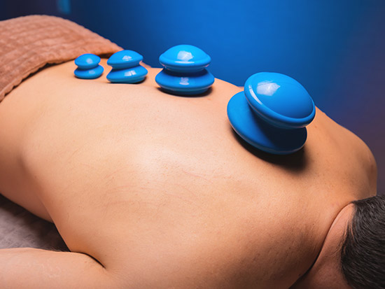Cupping Durham Region by Lisa at Mindfulness Massage Therapy